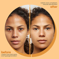 The Original Turmeric & Kojic Glow Bar ™